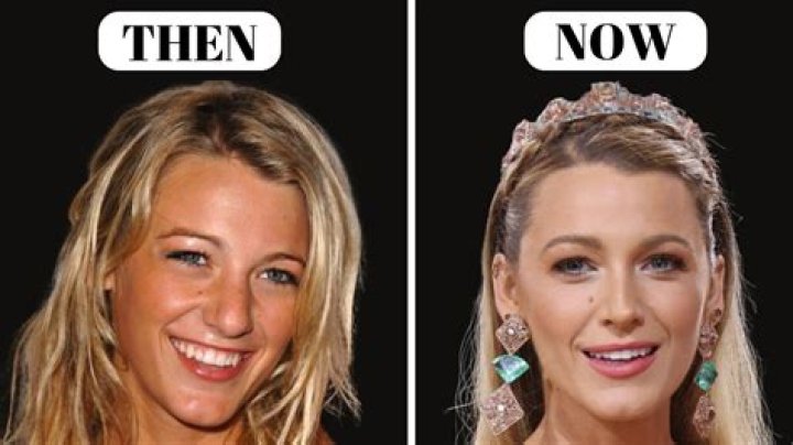 Blake Lively before and after the rumoured nose job she's never admitted to |