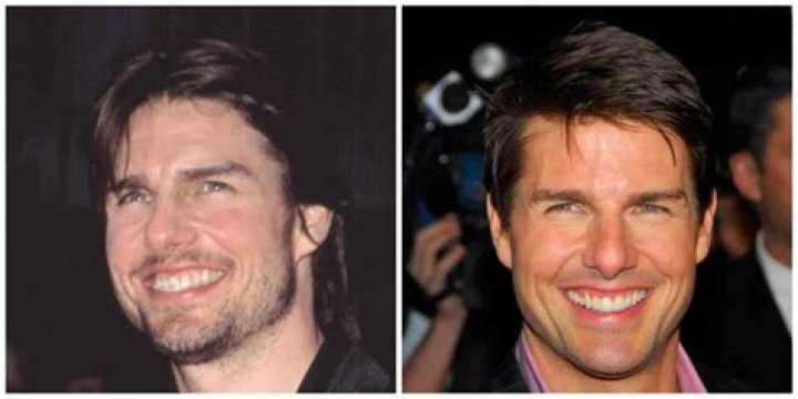 Exploring Tom Cruise's Hollywood Smile
