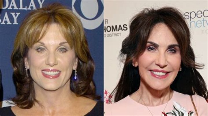 Discover The Truth Behind Dr. Phil's Wife's Plastic Surgery