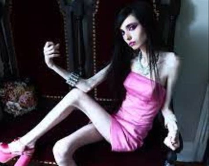 Eugenia Cooney Weight Loss Before And After