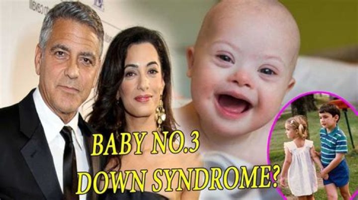 George Clooney Twins Down Syndrome: An Insightful Exploration