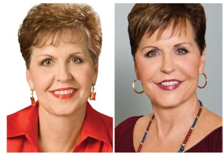 Joyce Meyer Plastic Surgery