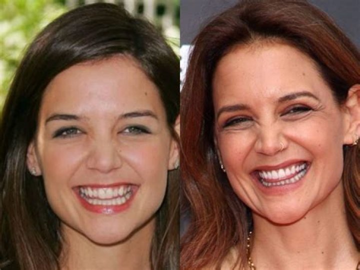 Uncover The Secrets Of Katie Holmes' Eye Surgery Transformation
