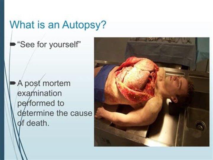 Katie Meyer Autopsy What S The Cause