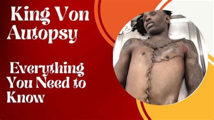 King Von Autopsy: Understanding the Impact and Legacy of a Hip-Hop Icon