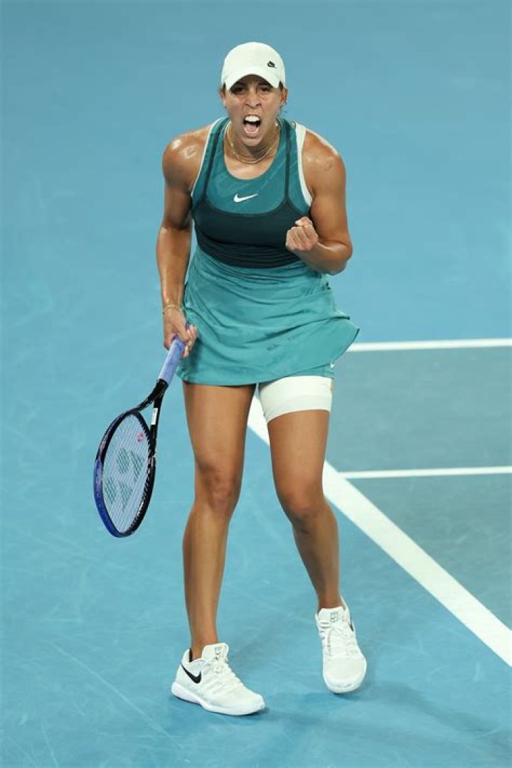 Madison Keys Teeth The Tennis Star Responds