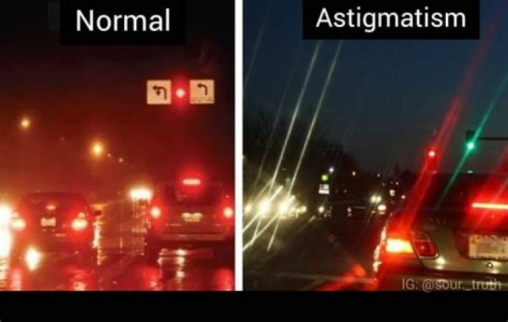 Unveiling The Secrets Of Night Driving With Astigmatism: Eye-Opening Insights
