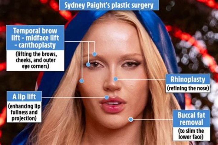 Sydney Love Island Before Surgery